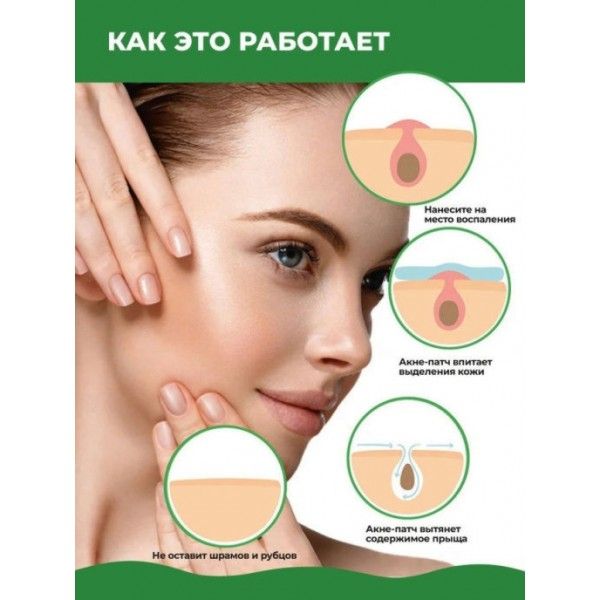 Точечные патчи от прыщей ELAIMEI Acne Pimple Patch 24 шт PT02 фото