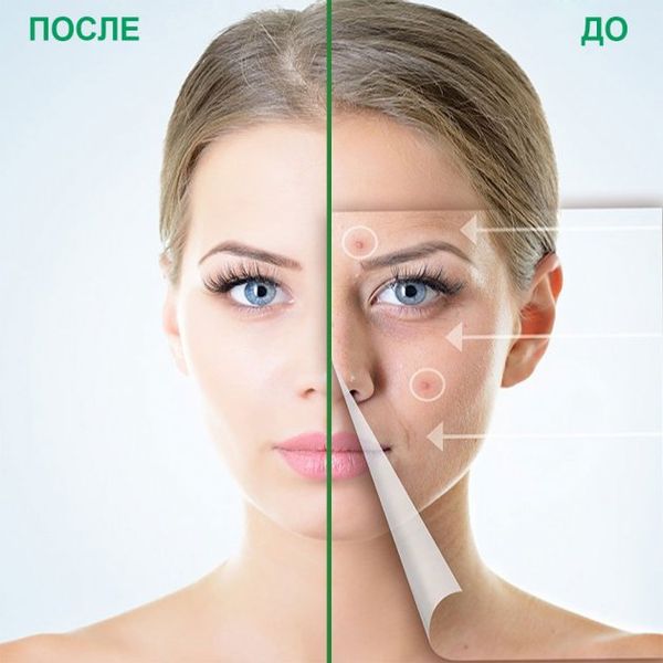 Точкові патчі від прищів ELAIMEI Acne Pimple Patch 24 шт PT02 фото