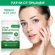 Точечные патчи от прыщей ELAIMEI Acne Pimple Patch 24 шт PT02 фото 1