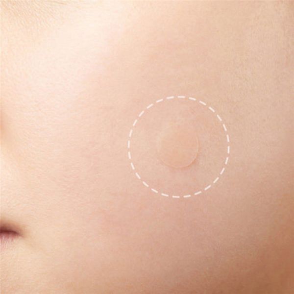 Точечные патчи от прыщей Acne Patch 36 шт PT01a фото